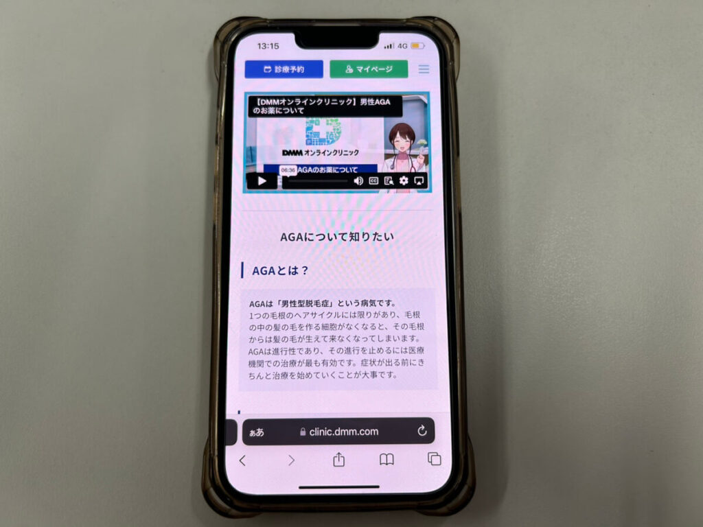 AGAとは